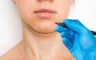 Cirujanos plásticos reconocidos en León