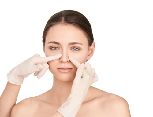 5 cosas que deberían saber antes de una cirugía de nariz