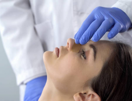 ¿Cómo limpiarse la nariz luego de la rinoplastia?