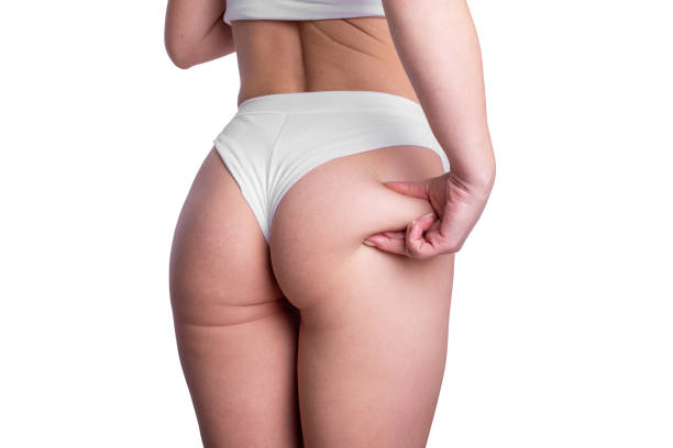 Operación de glúteos en León