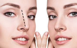 cirugía de nariz en León