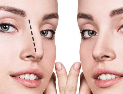 ¿Se puede deformar la nariz tras una cirugía de nariz en León?