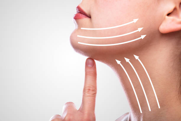 Estiramiento facial en León