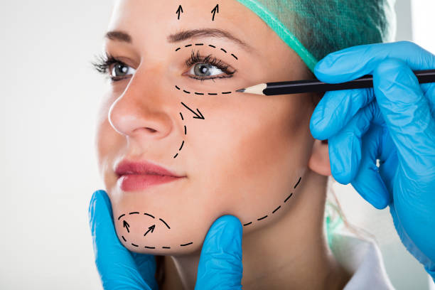 Estiramiento facial en León