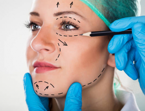 5 factores que influyen en el resultado de un estiramiento facial en León