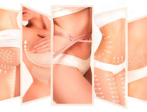 Antes de la lipoescultura: Entrena tu core y recupérate mejor