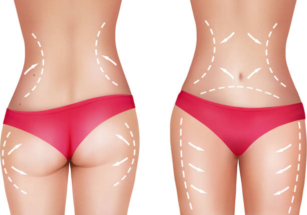 abdomen, muslos y glúteos