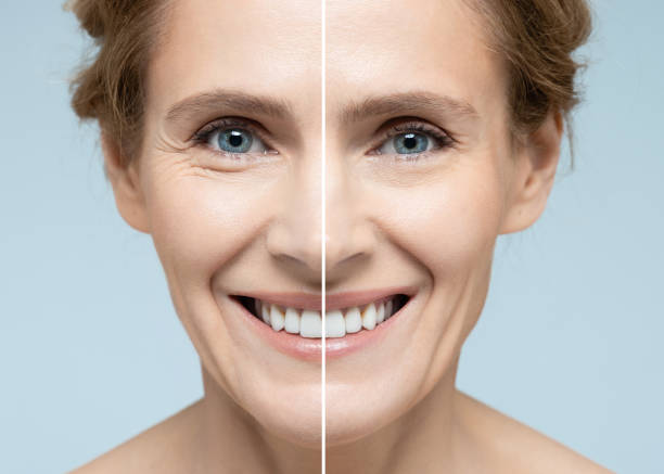 antes y después de la cirugía