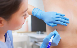 Levantamiento de busto