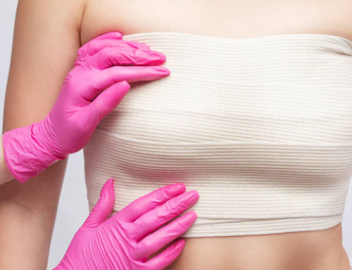 ¿Se puede realizar un levantamiento de busto solo con grasa propia?