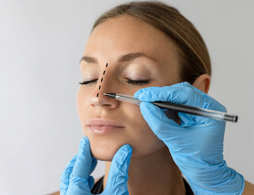 ¿Cómo funciona la rinoplastia funcional para mejorar la respiración?