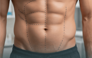 abdomen masculino