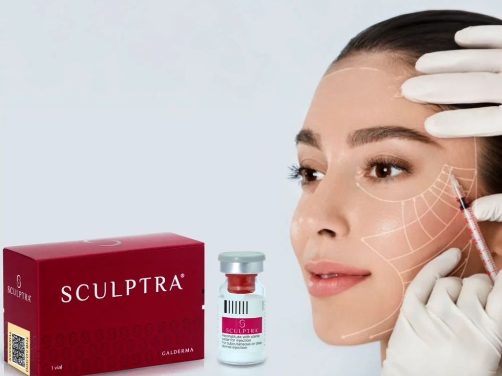 mujer con tratamiento de Sculptra