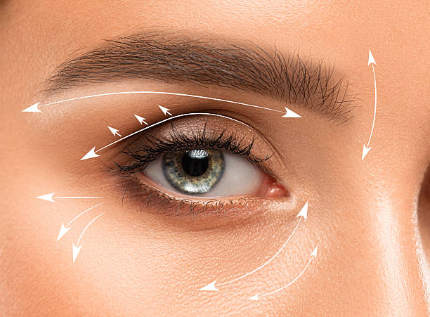 ojo de mujer con marcas