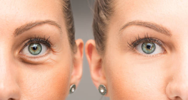 ojos de mujer