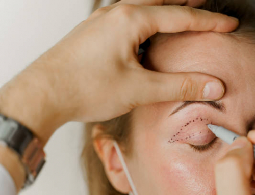 Cirugía de párpados en León: ¿Cuándo es por estética o por salud visual?