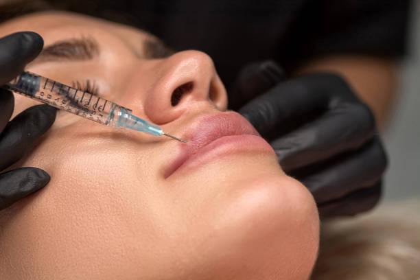 mujer recibiendo inyección en labios
