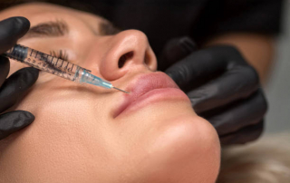 mujer recibiendo inyección en labios