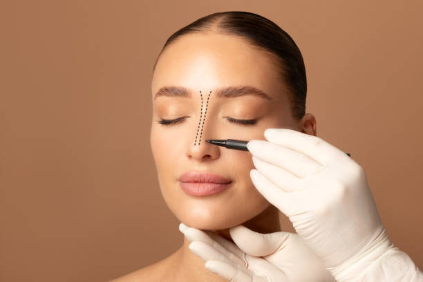 mujer con rinoplastia