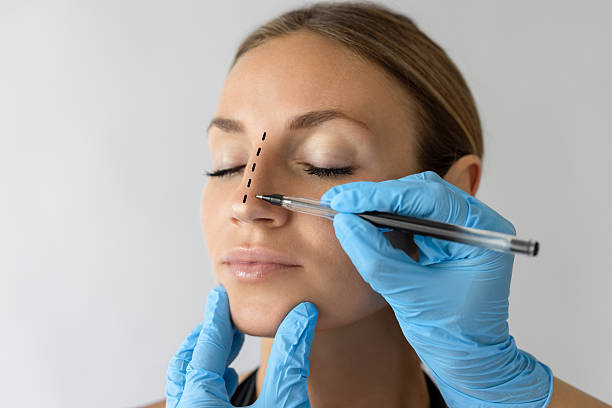 mujer con rinoplastia
