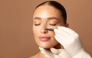 mujer con rinoplastia