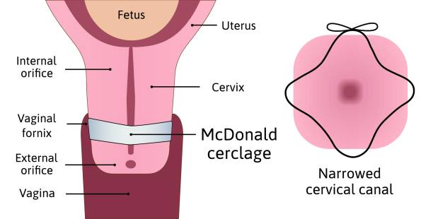 diagrama de vagina