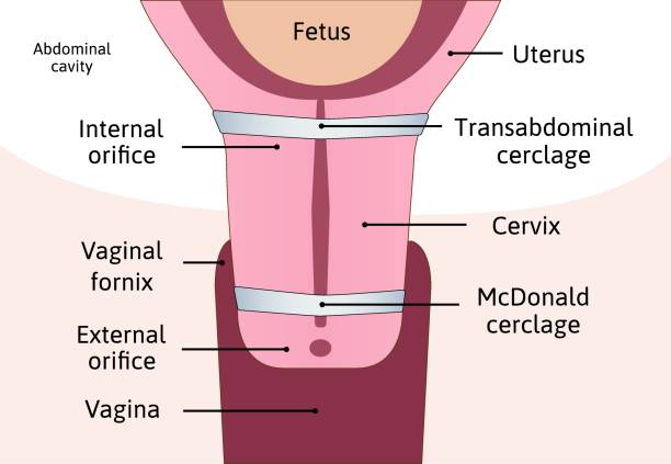 diagrama de vagina