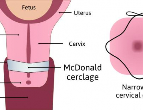 La importancia de la valoración antes del tensado vaginal